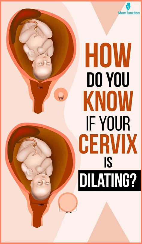 cervical dilation chart|cervix dilation symptoms.